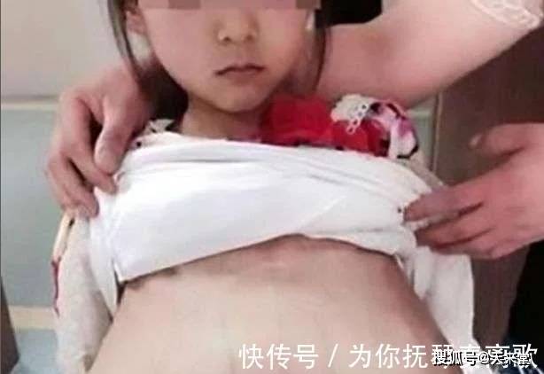 26岁女子误以为痛经，竟发现即将临盆